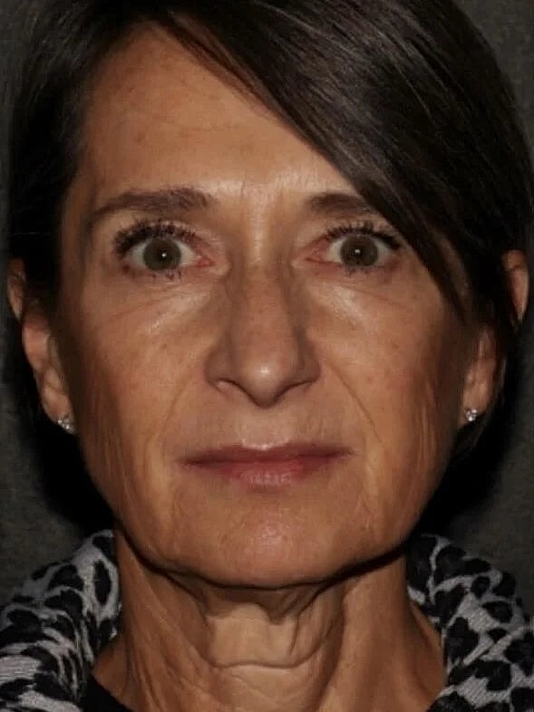Close-up of a woman with serious expression.
