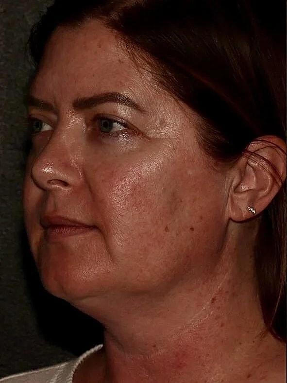 Profile view of a woman with medium-length hair.