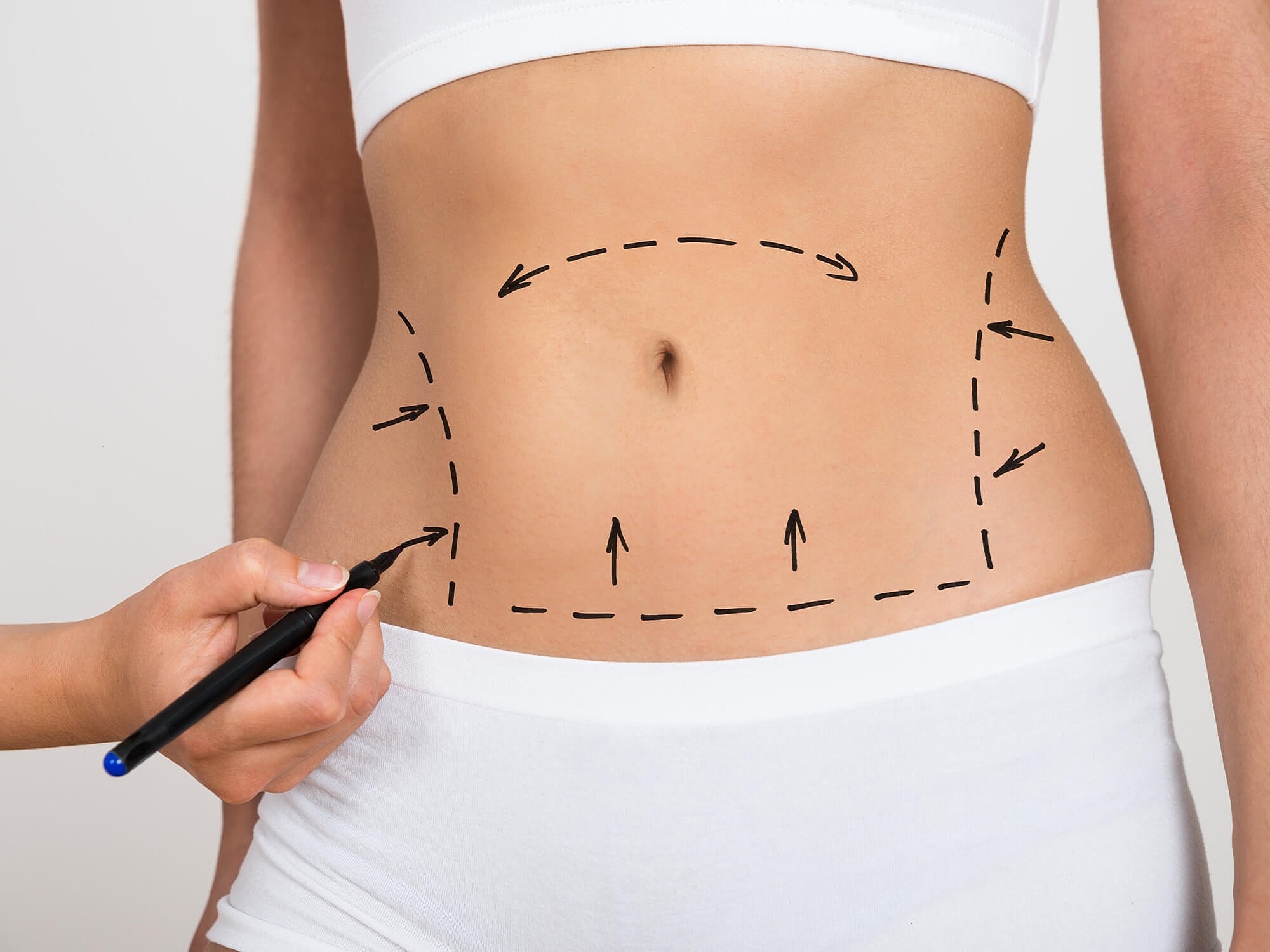 The Dos and Don’ts of Body Contouring